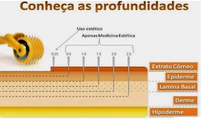 tamanho das agulhas para microagulhamento - curso de microagulhamento estetik cursos ead